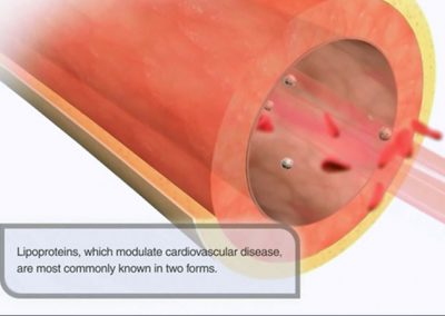 Cerenis Cardiovascular MOA 3D Video Animation